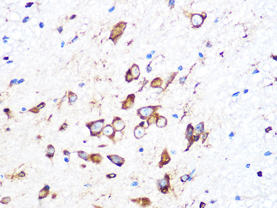 PUMA alpha Antibody in Immunohistochemistry (Paraffin) (IHC (P))