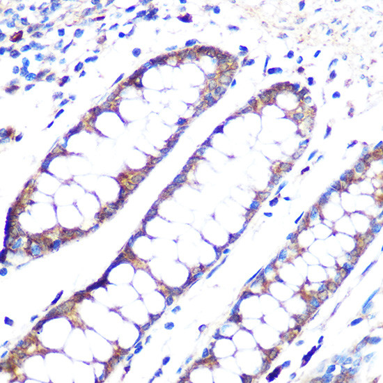 Angiopoietin 1 Antibody in Immunohistochemistry (Paraffin) (IHC (P))