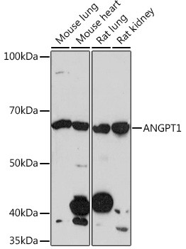 Angiopoietin 1 Antibody in Western Blot (WB)