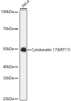 Cytokeratin 17 Antibody in Western Blot (WB)