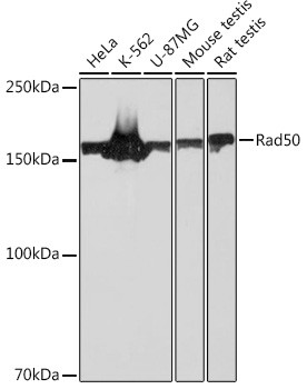 RAD50 Antibody in Western Blot (WB)