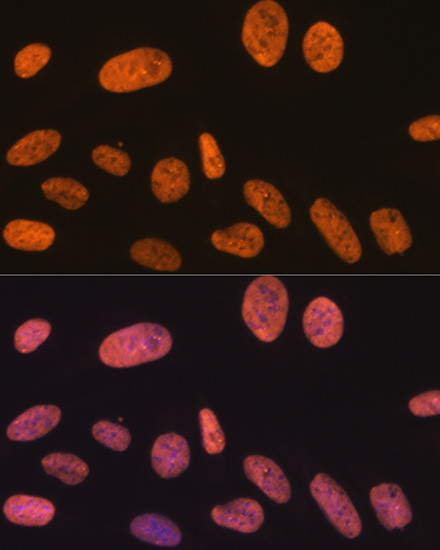 SAM68 Antibody in Immunocytochemistry (ICC/IF)