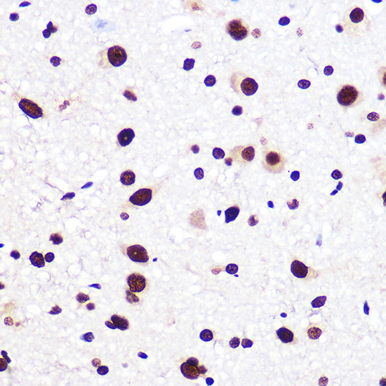 SAM68 Antibody in Immunohistochemistry (Paraffin) (IHC (P))