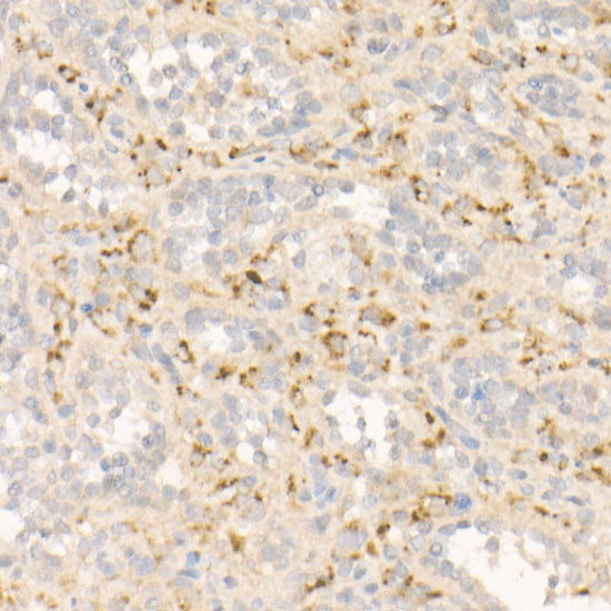 FGF21 Antibody in Immunohistochemistry (Paraffin) (IHC (P))