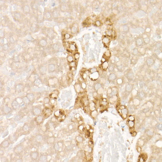 FGF21 Antibody in Immunohistochemistry (Paraffin) (IHC (P))