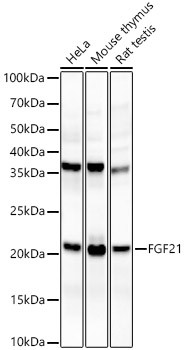 FGF21 Antibody in Western Blot (WB)