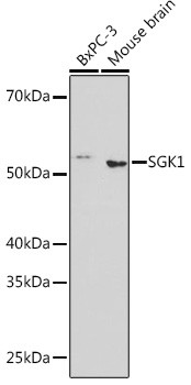 SGK1 Antibody in Western Blot (WB)