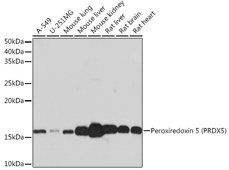 PRDX5 Antibody in Western Blot (WB)