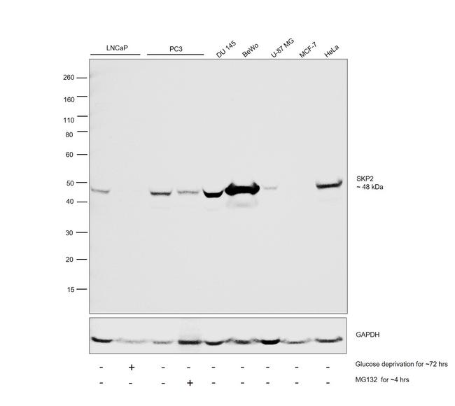 SKP2 Antibody in Western Blot (WB)