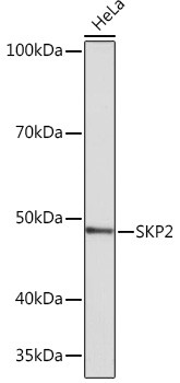 SKP2 Antibody in Western Blot (WB)