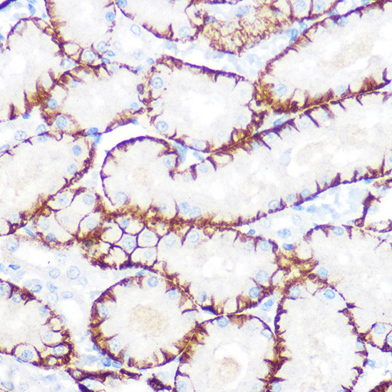 NDRG1 Antibody in Immunohistochemistry (Paraffin) (IHC (P))