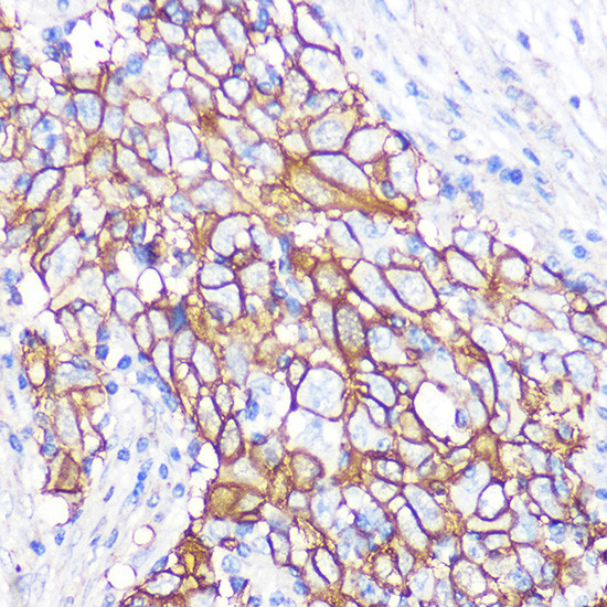 NDRG1 Antibody in Immunohistochemistry (Paraffin) (IHC (P))