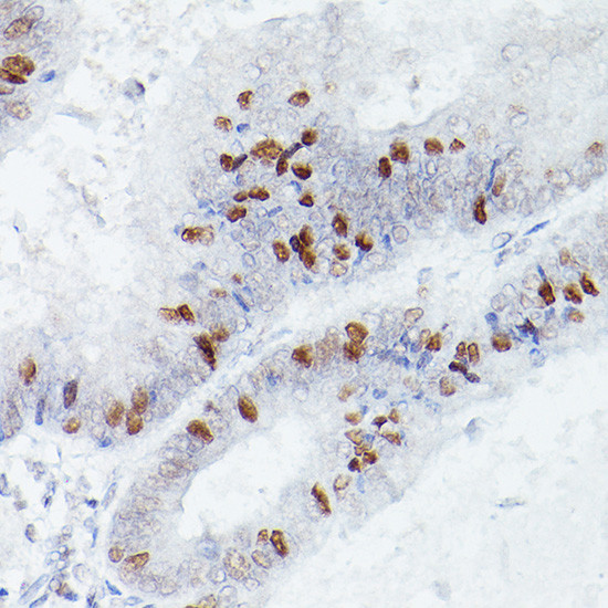 RBPJ Antibody in Immunohistochemistry (Paraffin) (IHC (P))