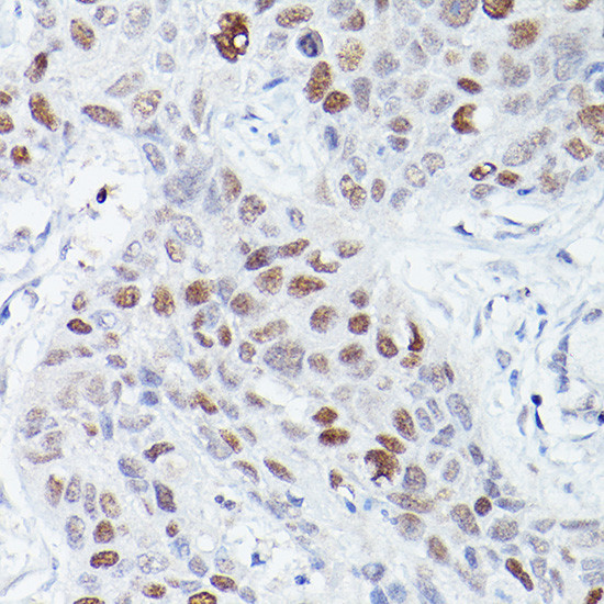 RBPJ Antibody in Immunohistochemistry (Paraffin) (IHC (P))