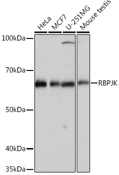 RBPJ Antibody in Western Blot (WB)