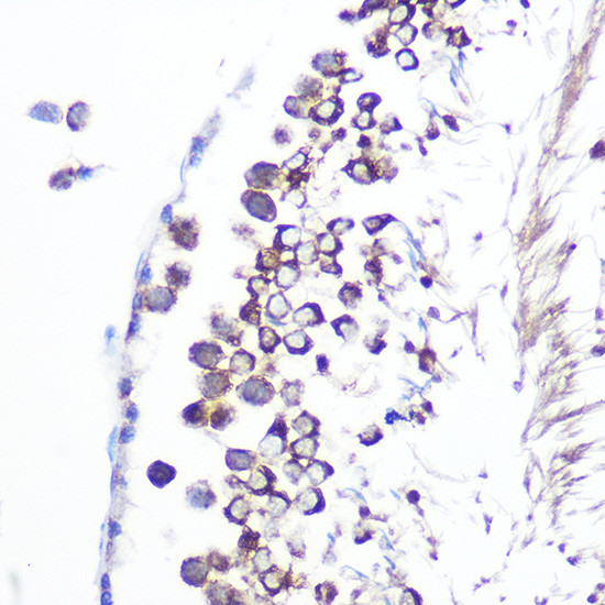 JAB1 Antibody in Immunohistochemistry (Paraffin) (IHC (P))