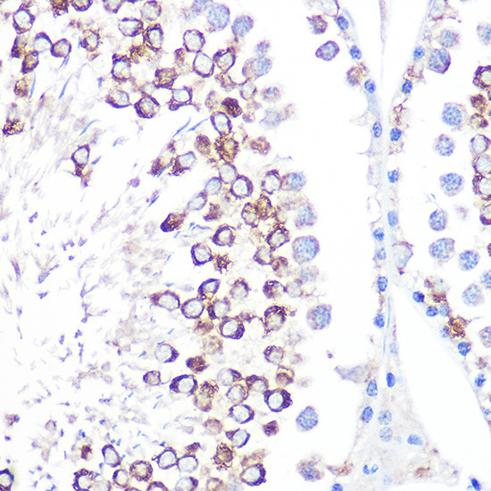 CD59 Antibody in Immunohistochemistry (Paraffin) (IHC (P))