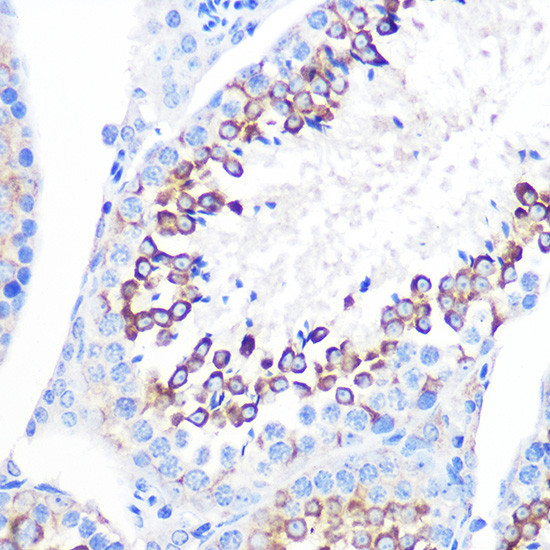 CD59 Antibody in Immunohistochemistry (Paraffin) (IHC (P))