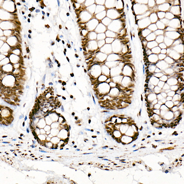 SRSF1 Antibody in Immunohistochemistry (Paraffin) (IHC (P))