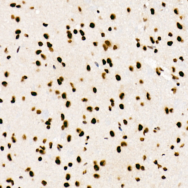 SRSF1 Antibody in Immunohistochemistry (Paraffin) (IHC (P))