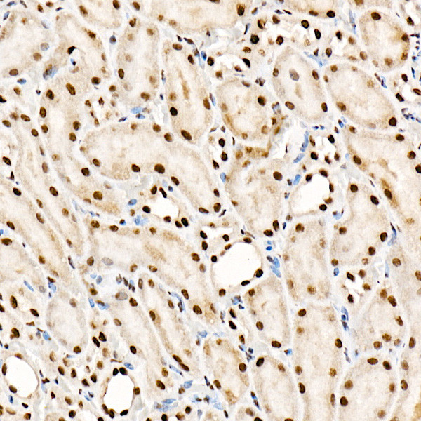 SRSF1 Antibody in Immunohistochemistry (Paraffin) (IHC (P))