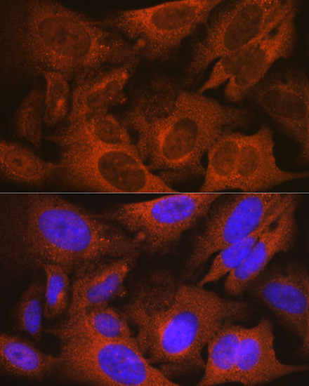 MSMB Antibody in Immunocytochemistry (ICC/IF)