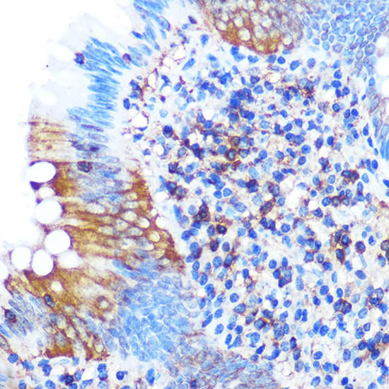 PGAM1 Antibody in Immunohistochemistry (Paraffin) (IHC (P))