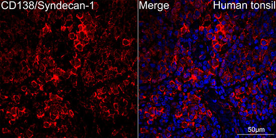 CD138 Antibody in Immunohistochemistry (Paraffin) (IHC (P))