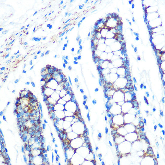 SFRP4 Antibody in Immunohistochemistry (Paraffin) (IHC (P))