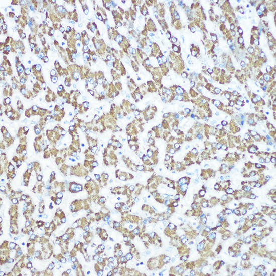 CPS1 Antibody in Immunohistochemistry (Paraffin) (IHC (P))