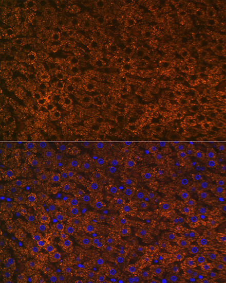 CPS1 Antibody in Immunohistochemistry (Paraffin) (IHC (P))