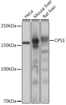 CPS1 Antibody in Western Blot (WB)