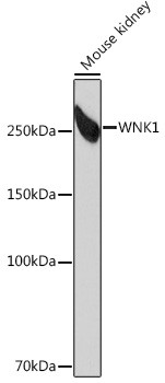 WNK1 Antibody in Western Blot (WB)