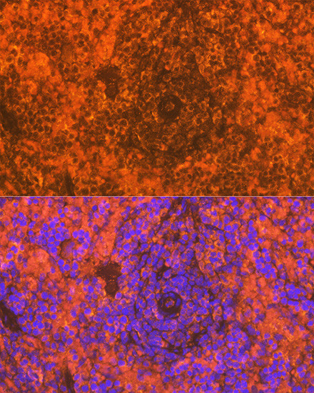 CD83 Antibody in Immunohistochemistry (Paraffin) (IHC (P))