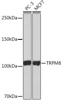 TRPM8 Antibody in Western Blot (WB)