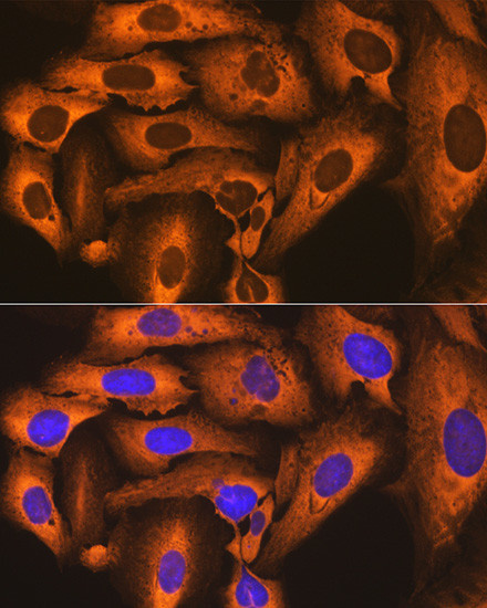 FKBP4 Antibody in Immunocytochemistry (ICC/IF)