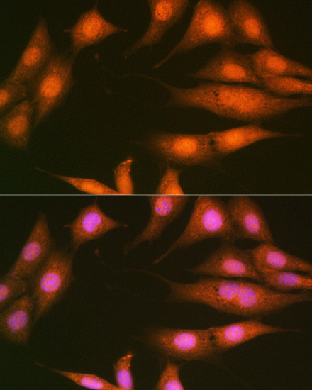 PP1 beta Antibody in Immunocytochemistry (ICC/IF)