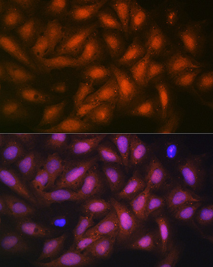 PP1 beta Antibody in Immunocytochemistry (ICC/IF)