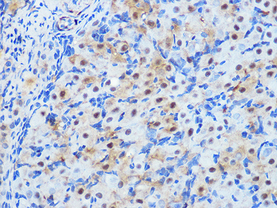 PP1 beta Antibody in Immunohistochemistry (Paraffin) (IHC (P))