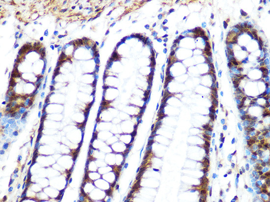 PP1 beta Antibody in Immunohistochemistry (Paraffin) (IHC (P))