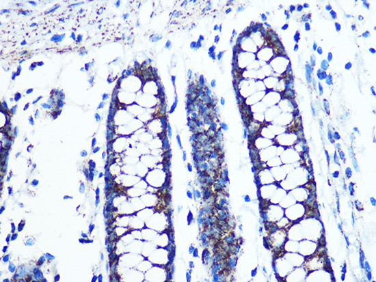 UQCRC2 Antibody in Immunohistochemistry (Paraffin) (IHC (P))