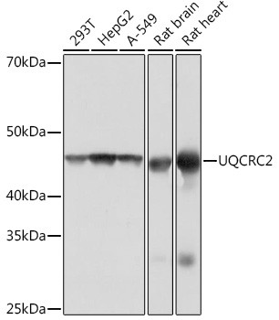 UQCRC2 Antibody in Western Blot (WB)