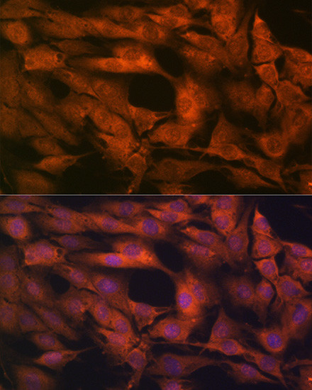 Laminin beta-1 Antibody in Immunocytochemistry (ICC/IF)