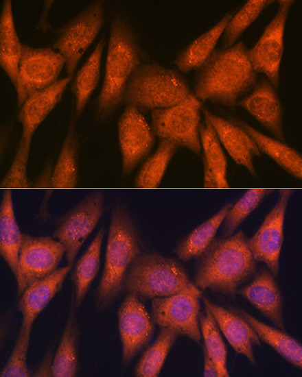 Laminin beta-1 Antibody in Immunocytochemistry (ICC/IF)