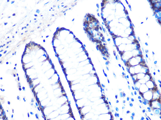 14-3-3 sigma Antibody in Immunohistochemistry (Paraffin) (IHC (P))