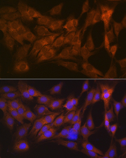 Tetranectin Antibody in Immunocytochemistry (ICC/IF)