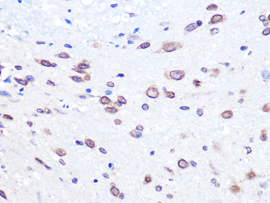 UBC9 Antibody in Immunohistochemistry (Paraffin) (IHC (P))