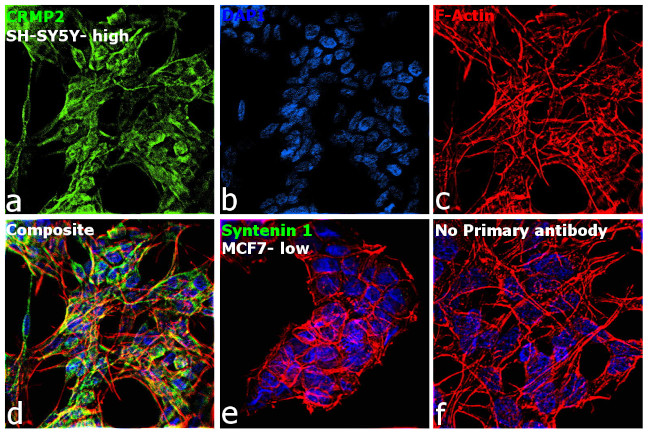 CRMP2 Antibody in Immunocytochemistry (ICC/IF)