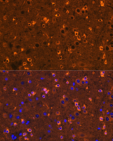 CRMP2 Antibody in Immunohistochemistry (Paraffin) (IHC (P))