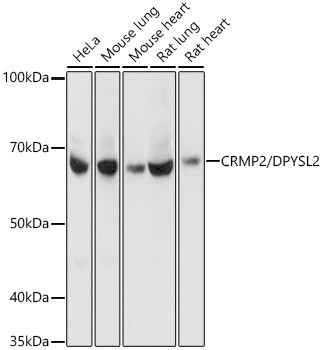 CRMP2 Antibody in Western Blot (WB)